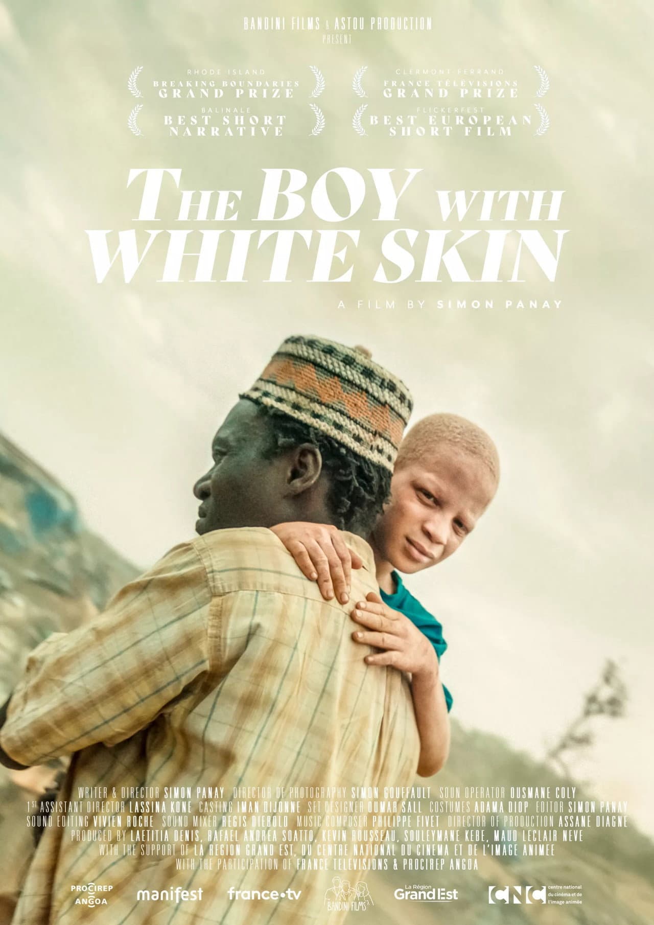 The Boy with White Skin preview 2