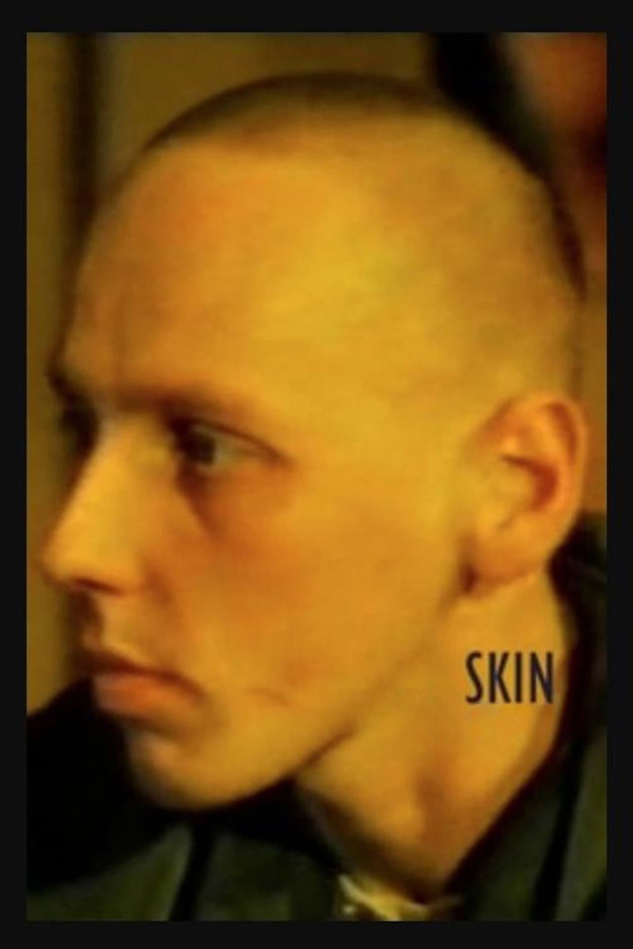 Skin preview 2
