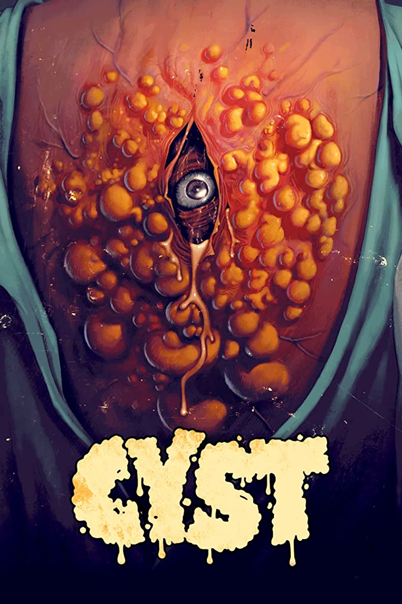 Cyst preview 2
