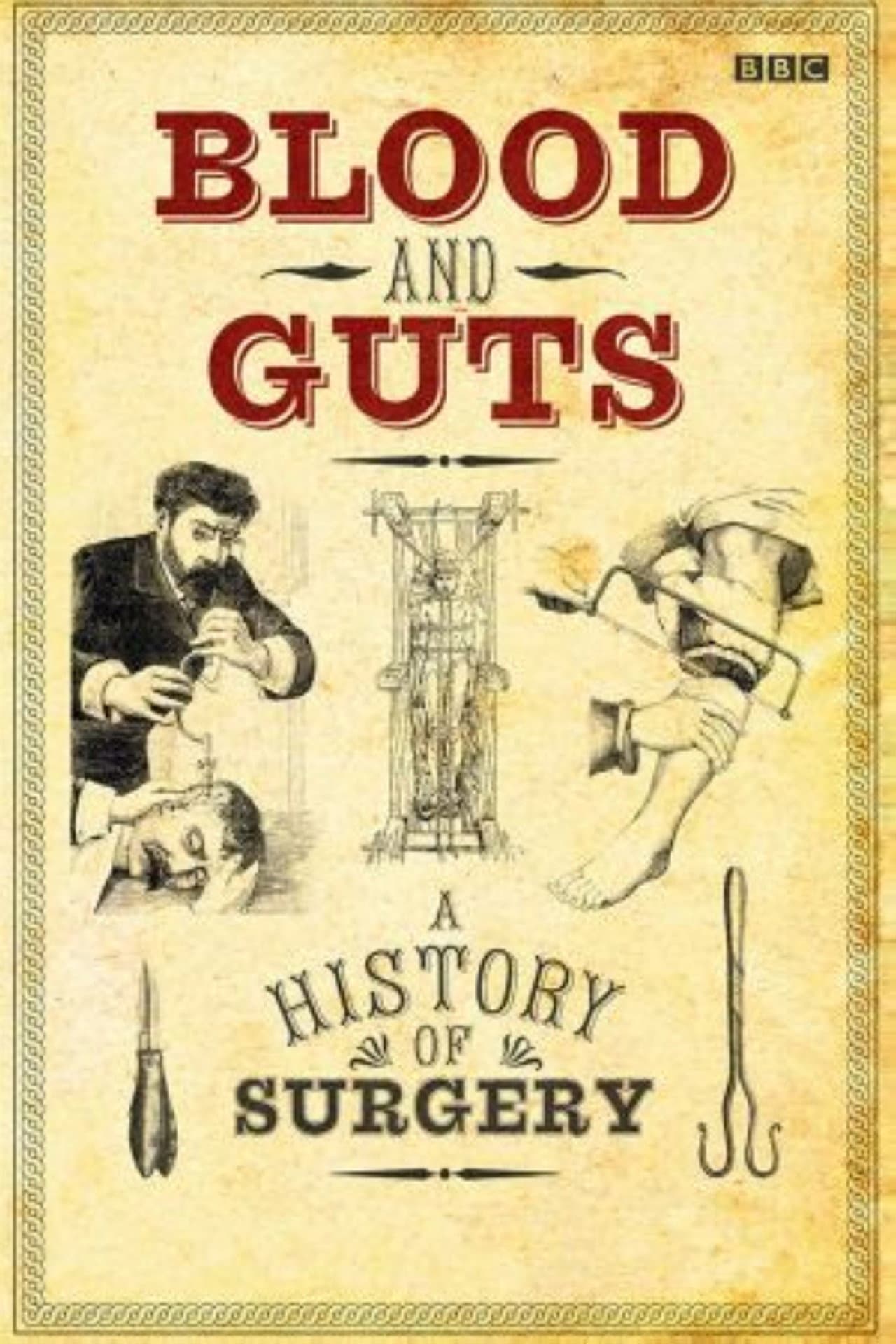 Blood and Guts: A History of Surgery preview 2
