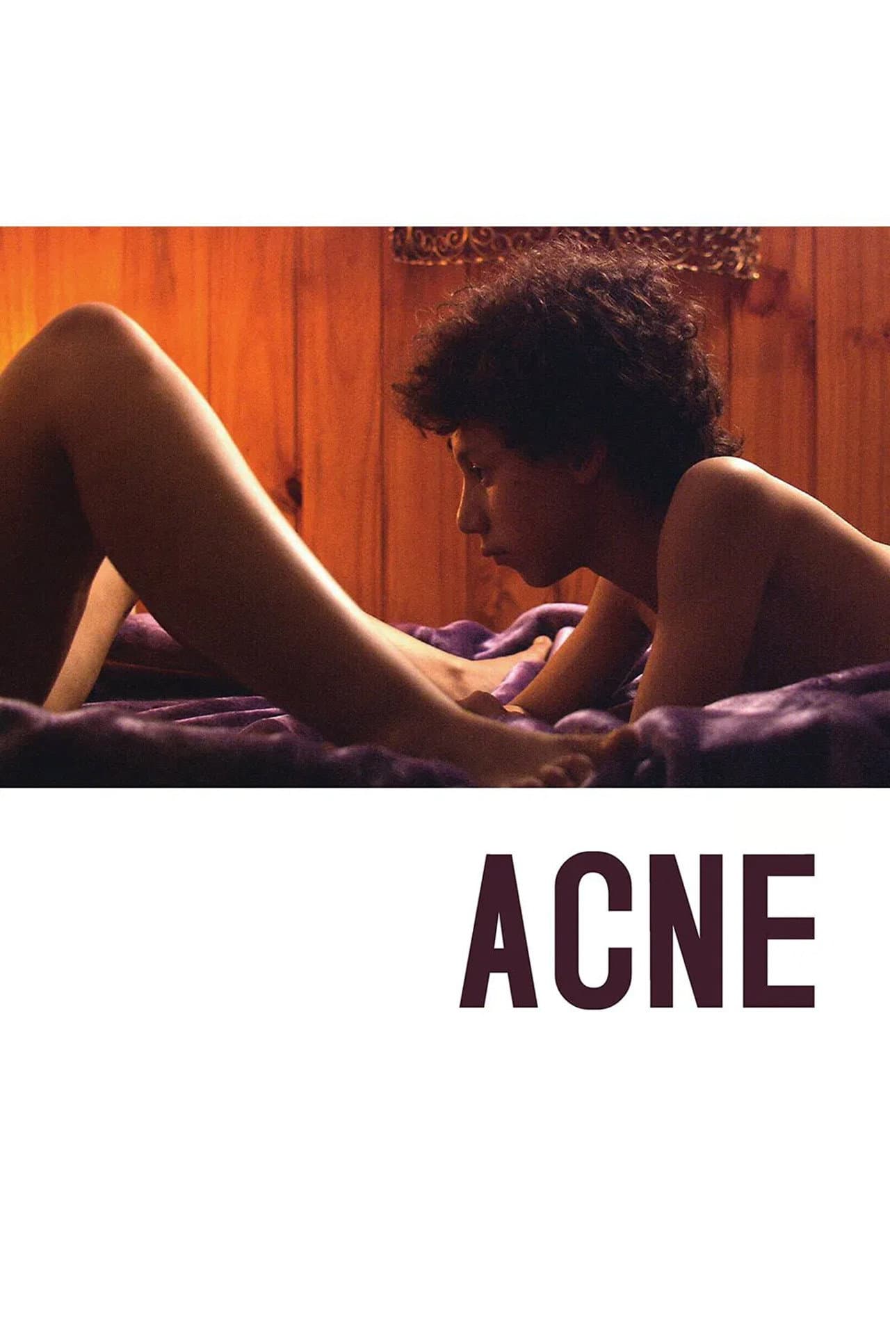 Acne preview 2