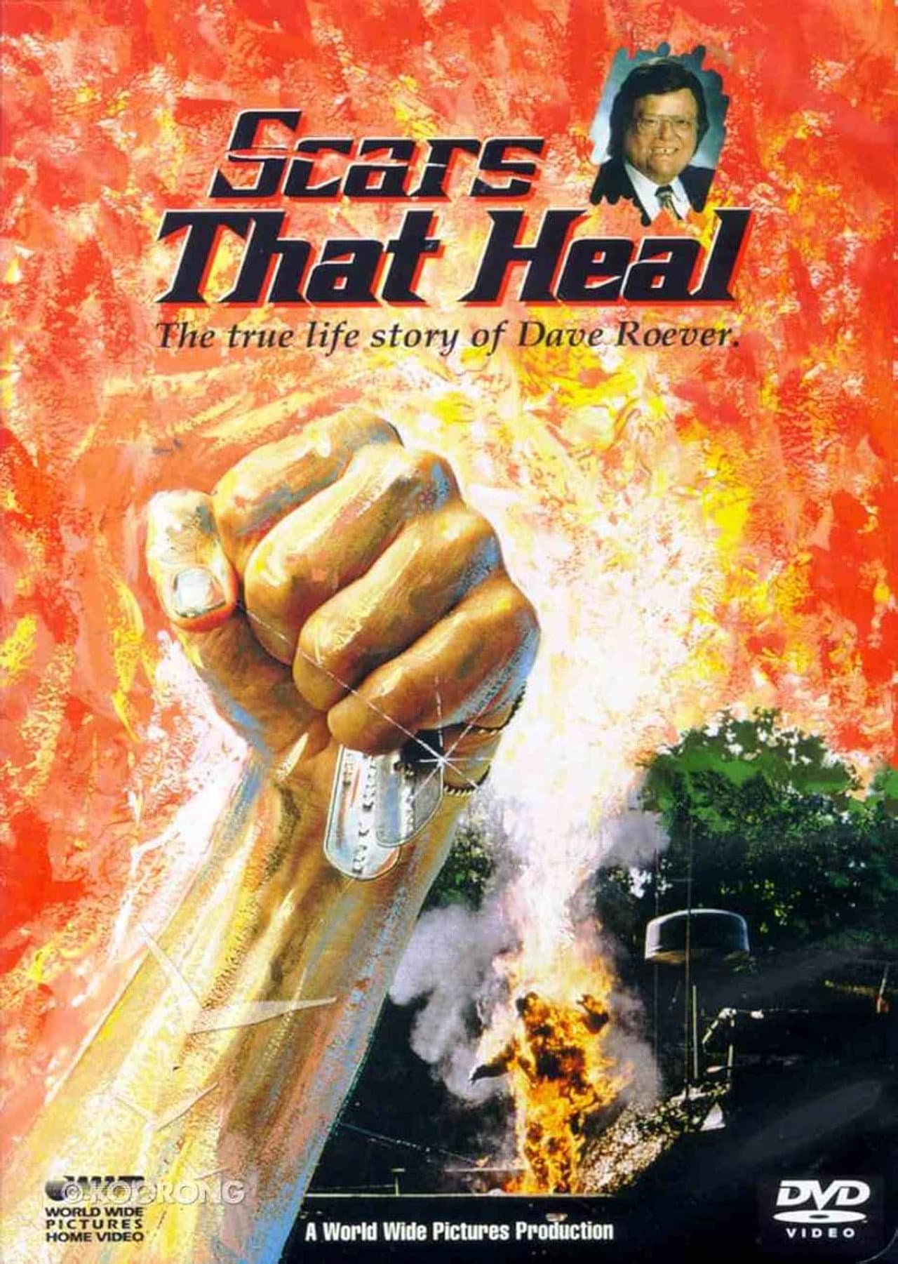 Scars That Heal: The Dave Roever Story preview 1