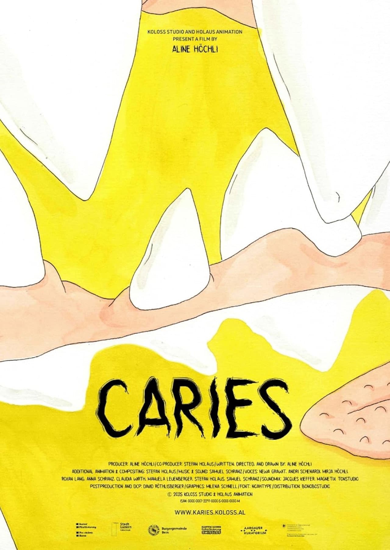 Caries preview 2