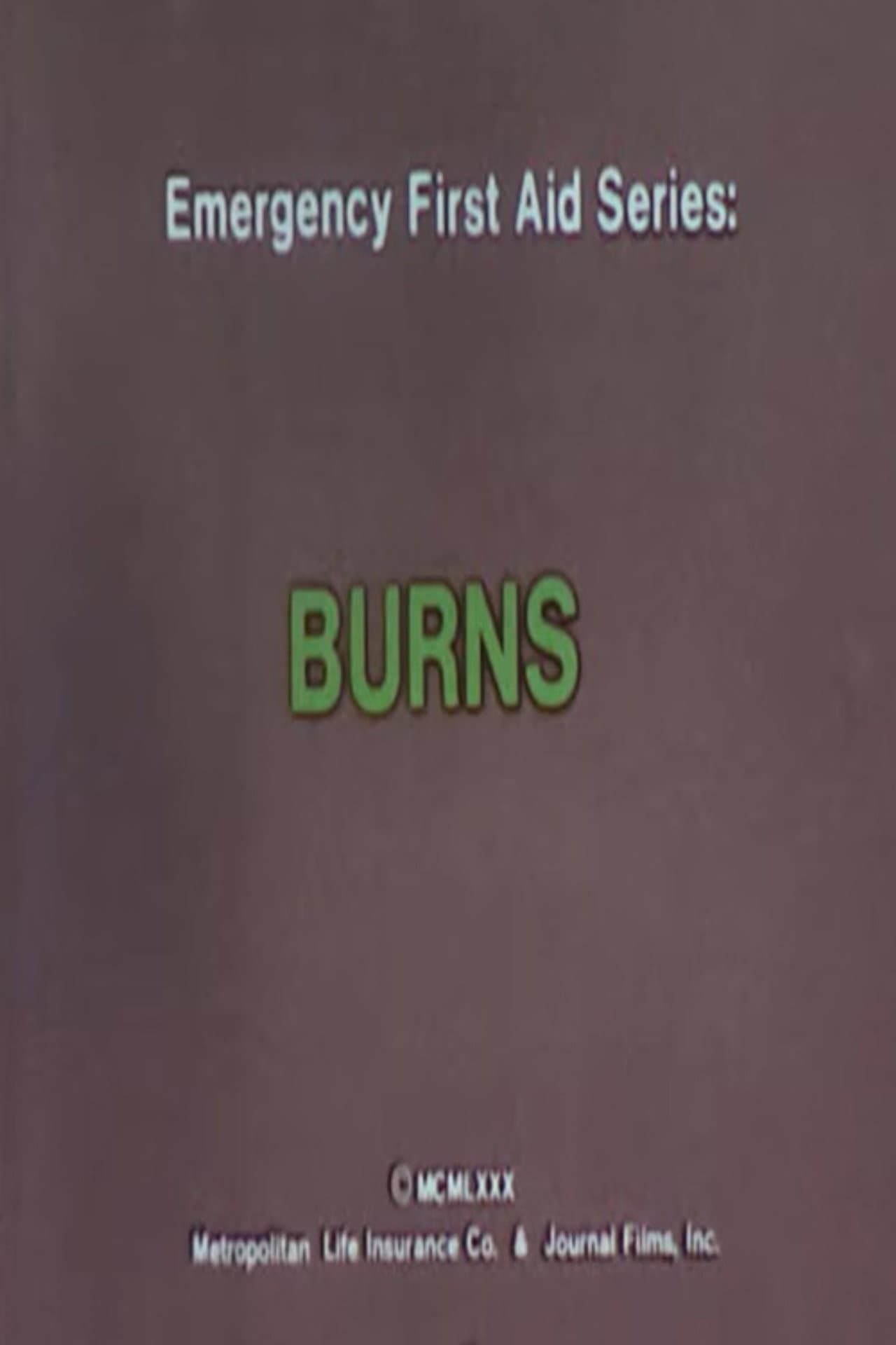 Emergency First Aid Series: Burns preview 2
