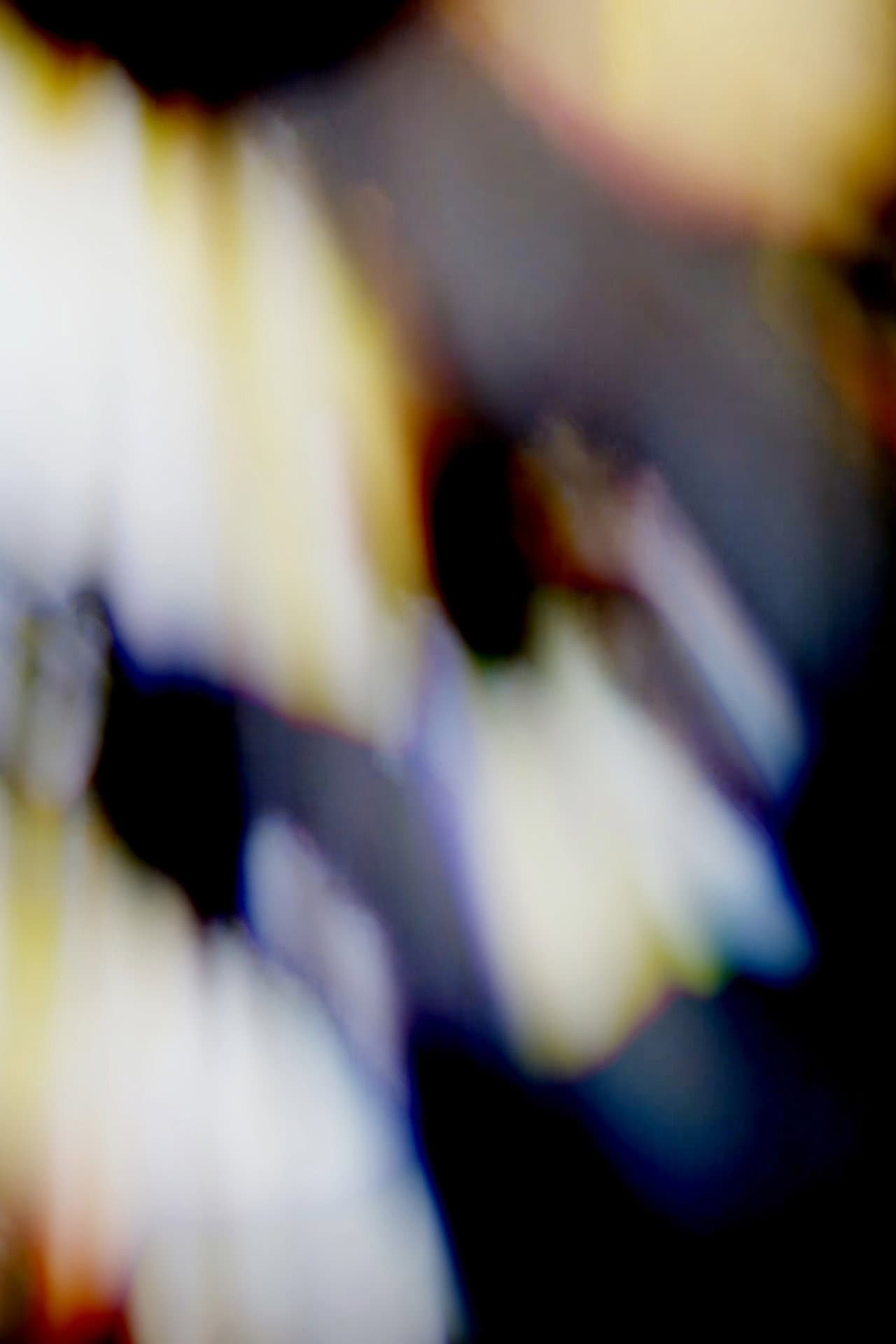 Blinded preview 2