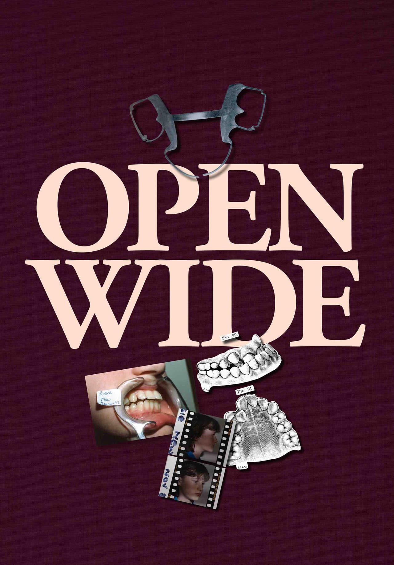 Open Wide preview 2