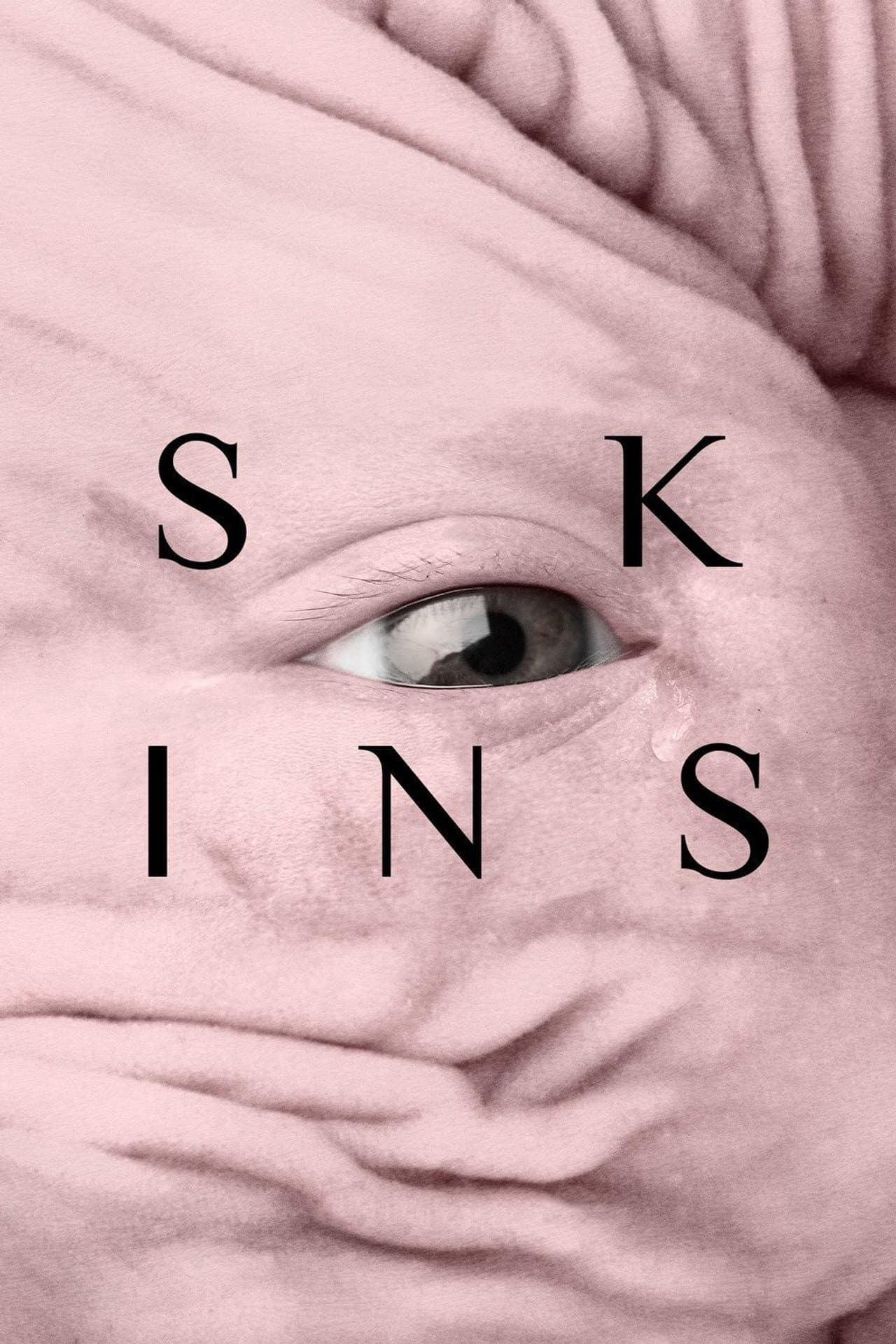 Skins preview 2