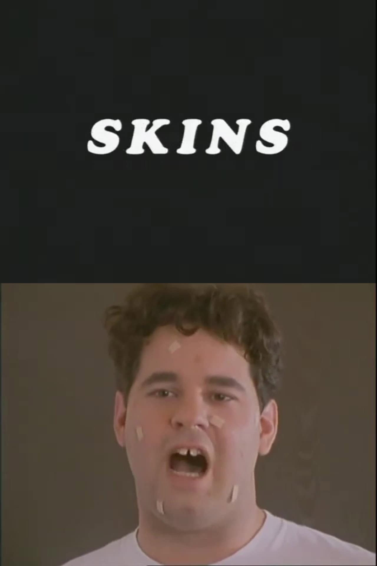 Skins preview 2