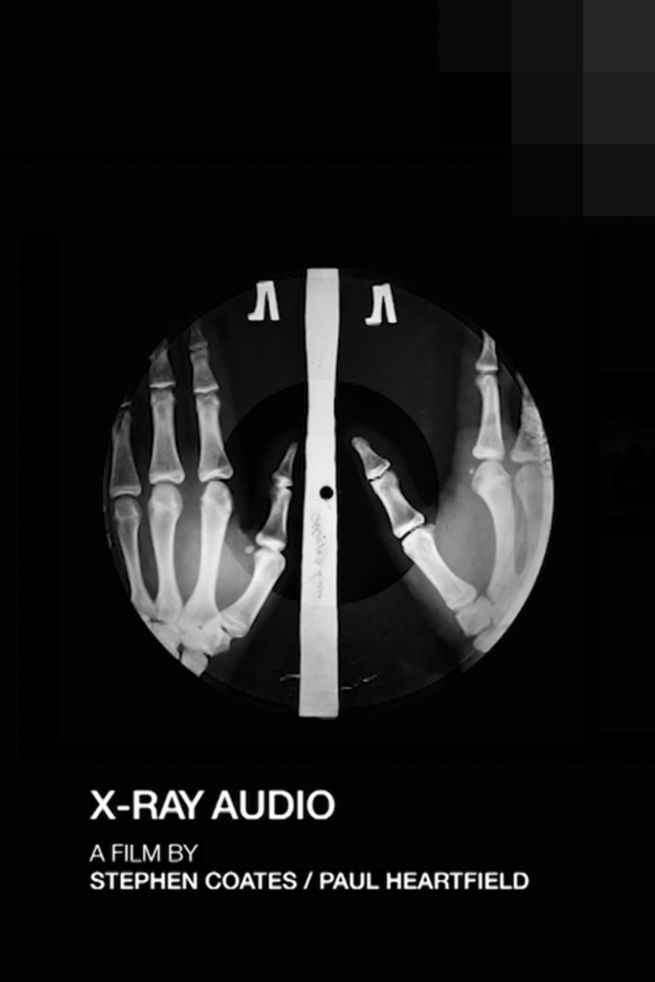 X-Ray Audio: The Documentary preview 1