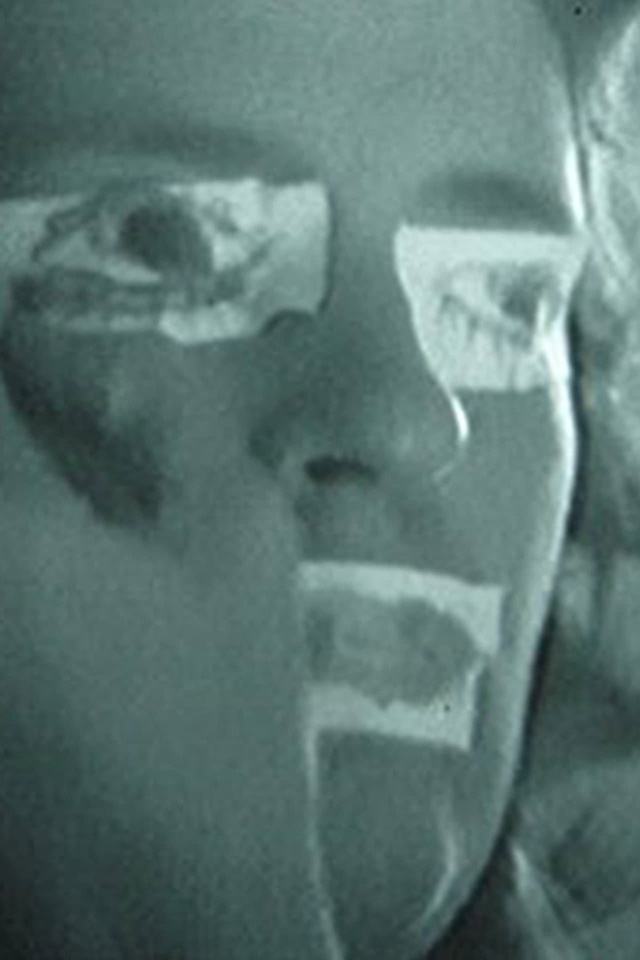 Preparação I preview 1