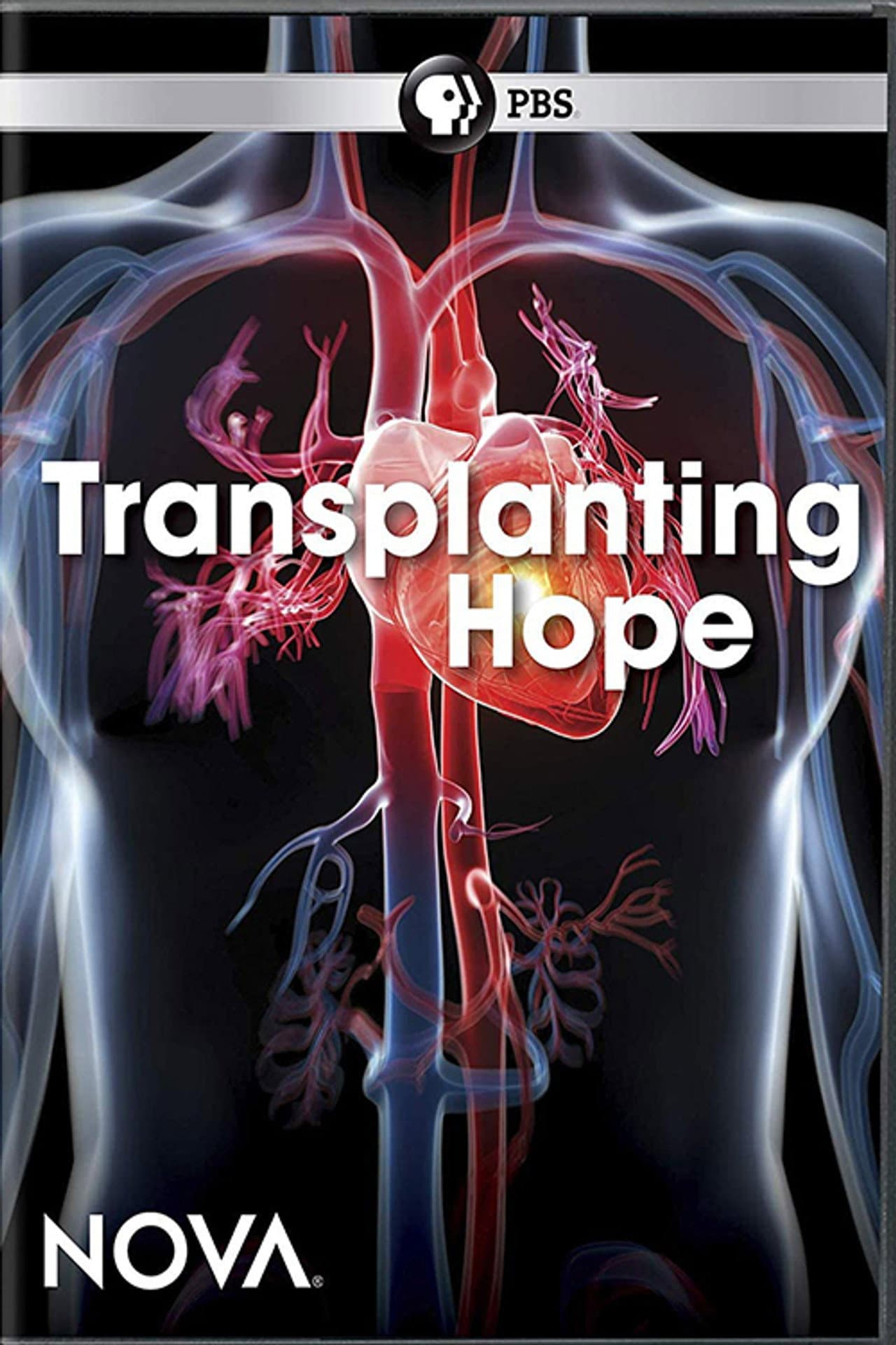 Transplanting Hope preview 1