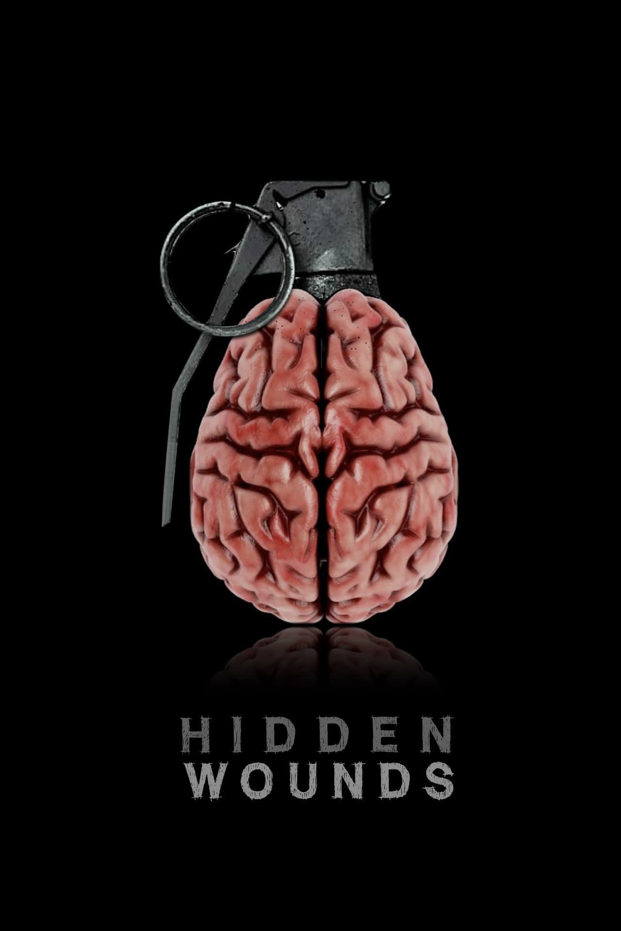 Hidden Wounds preview 2