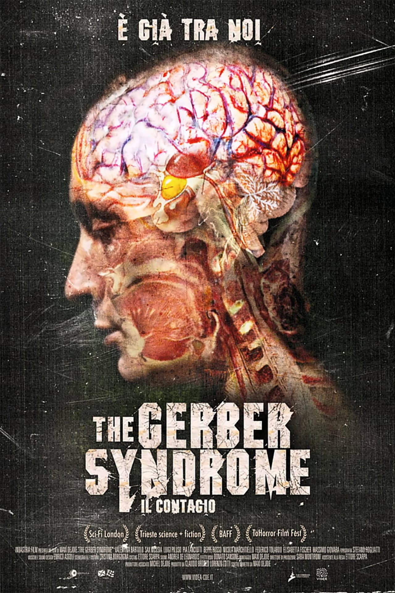 The Gerber Syndrome - Il contagio preview 2