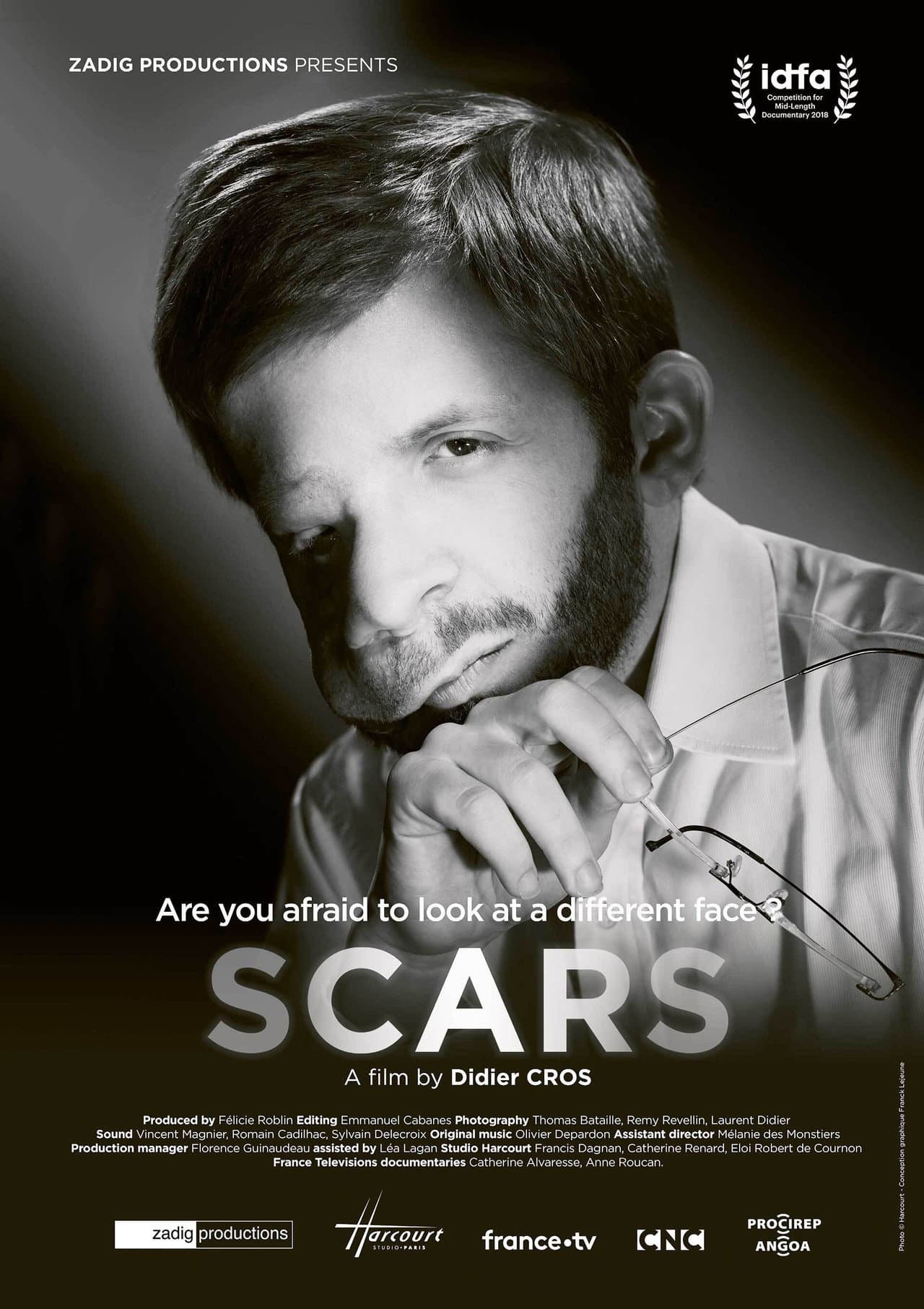 Scars preview 2