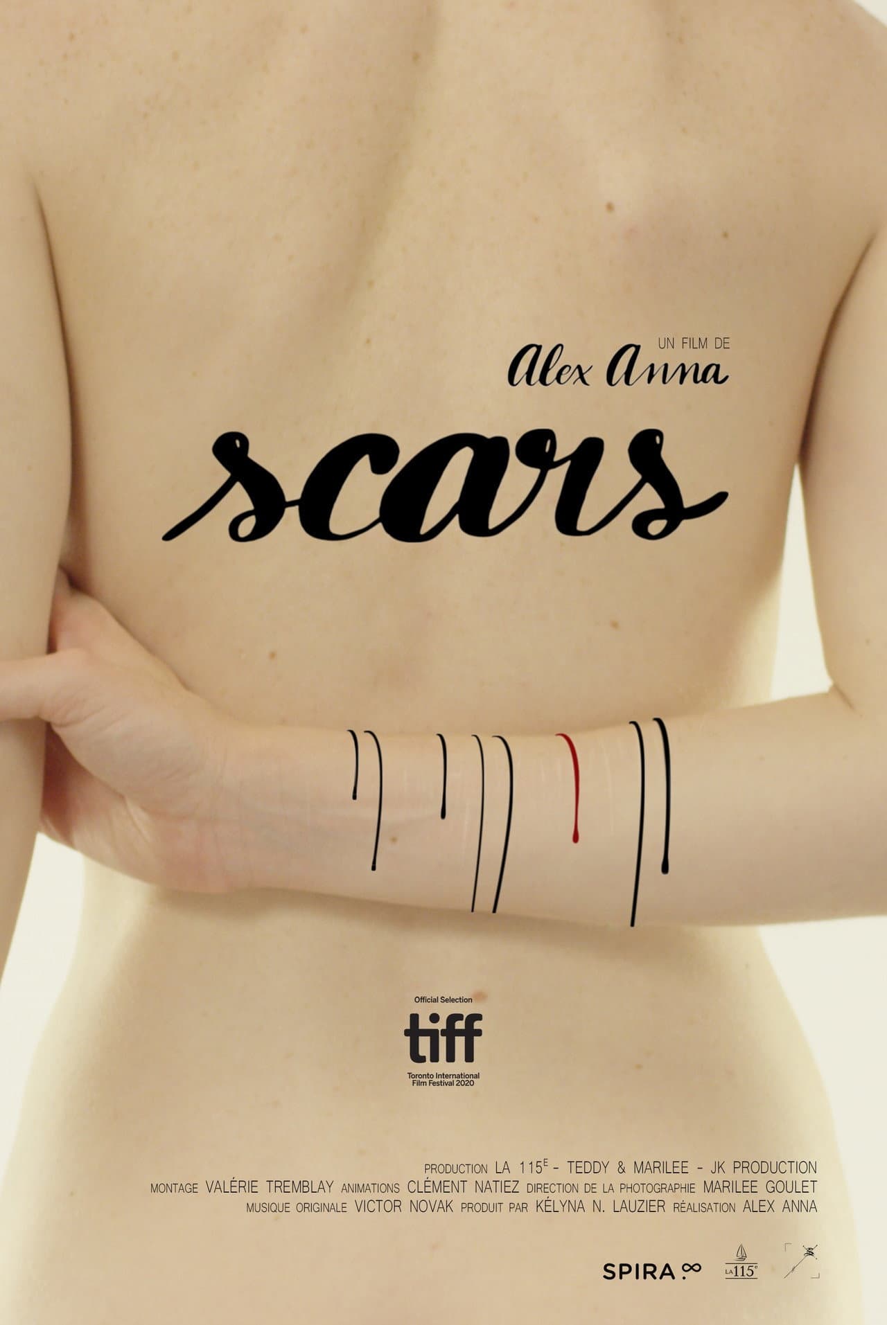 Scars preview 2