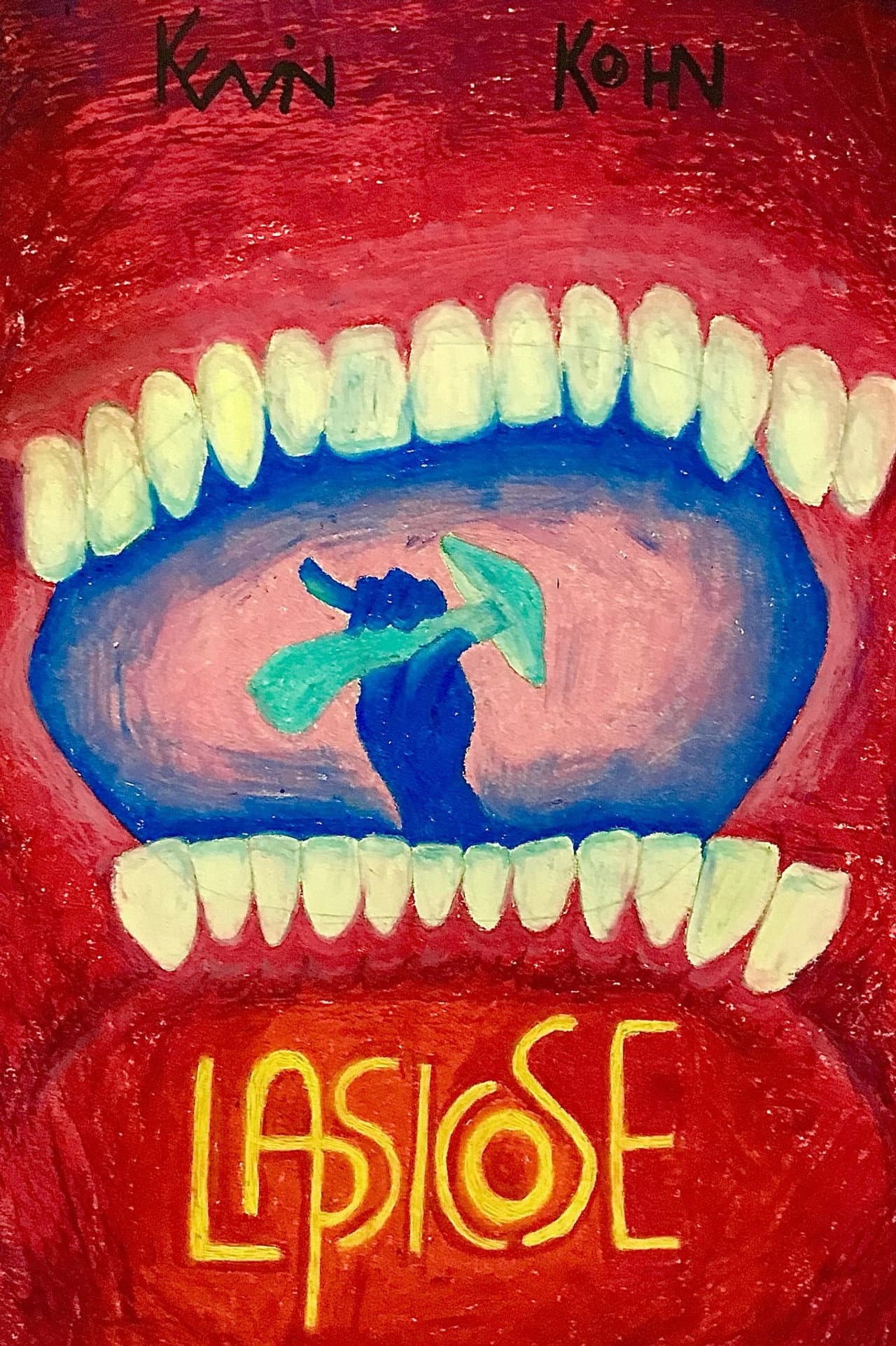 Lapsicose preview 1