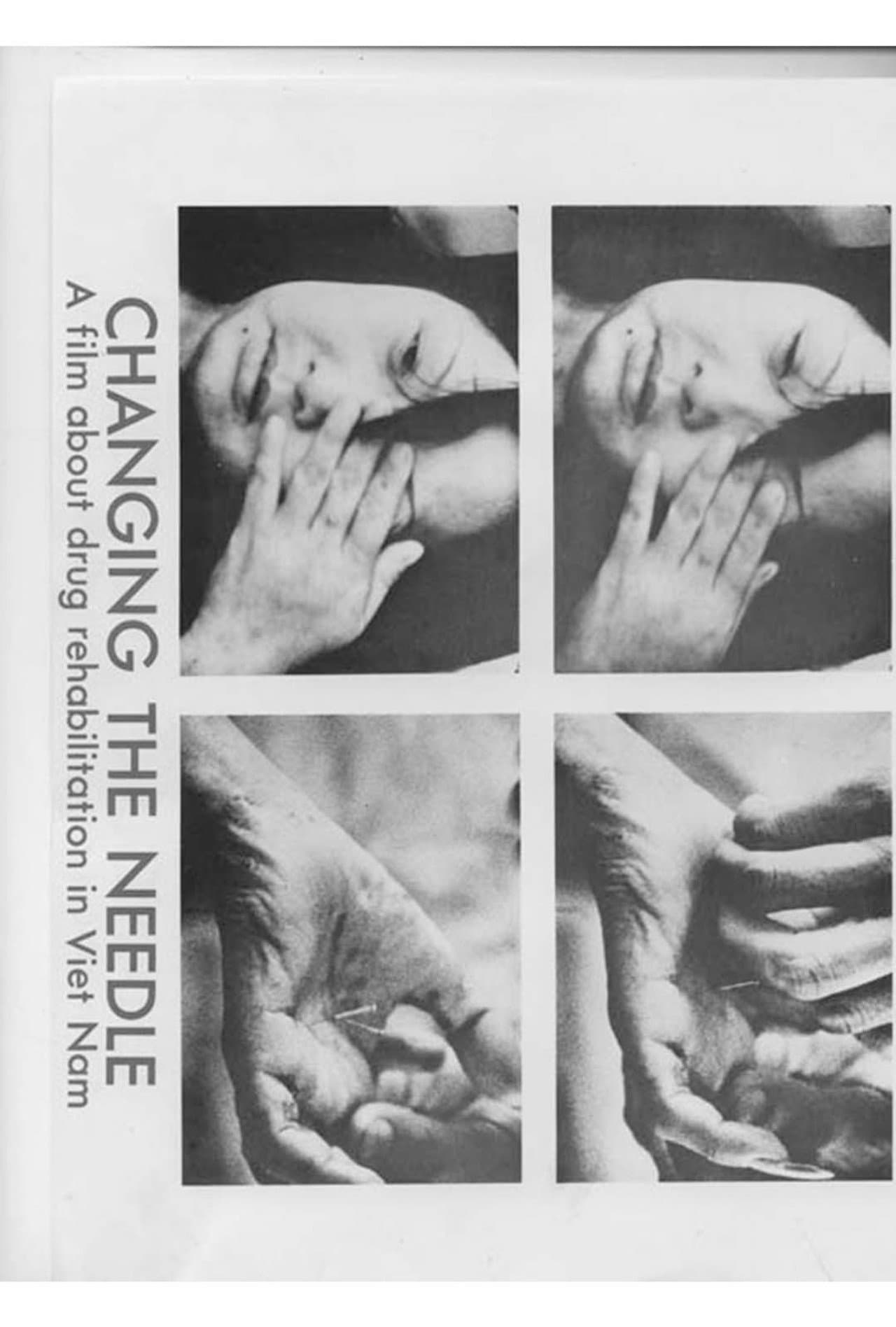 Changing the Needle preview 1