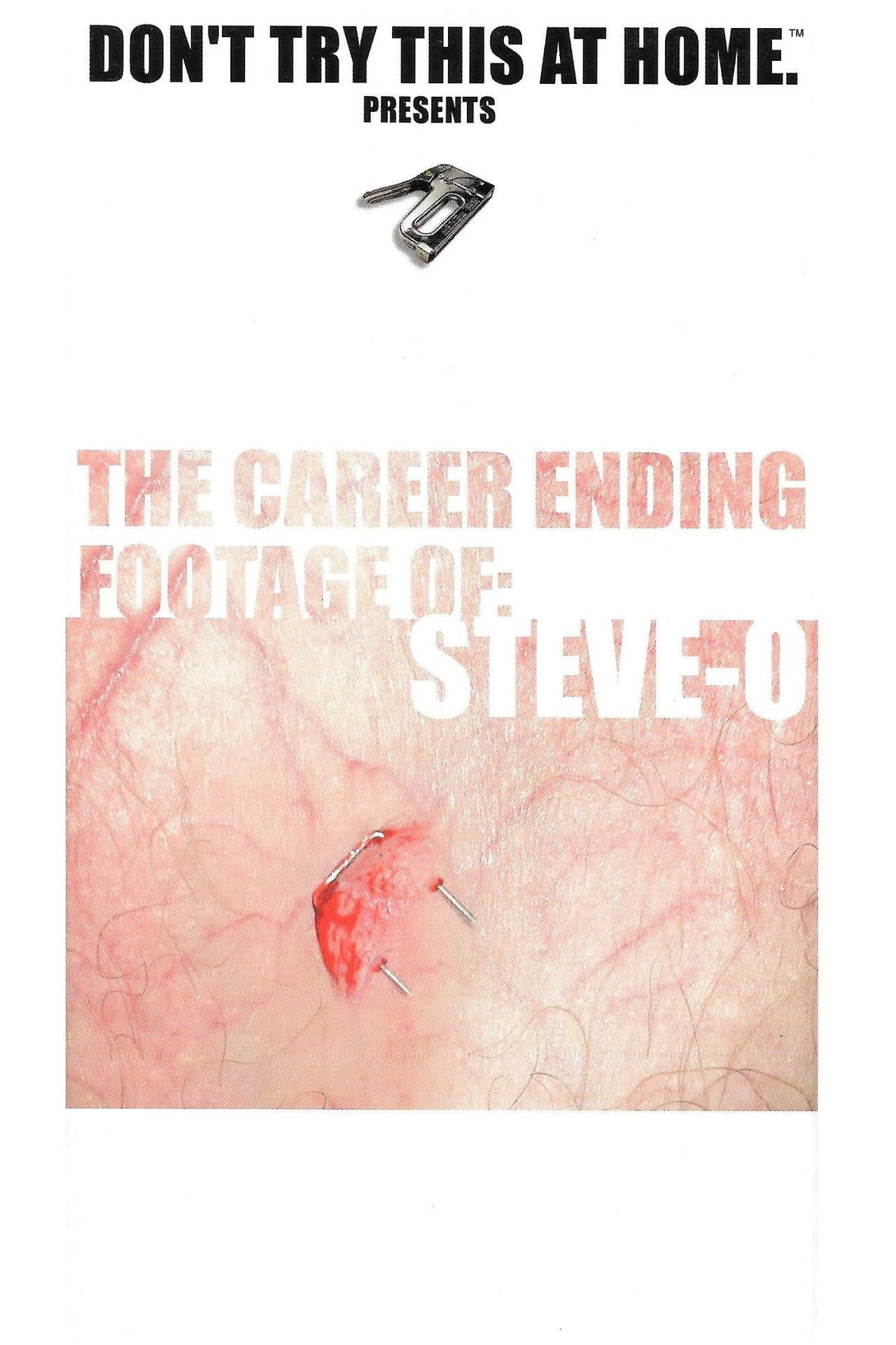 The Career Ending Footage of: Steve-O preview 1