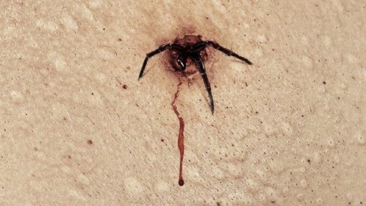 The Plague