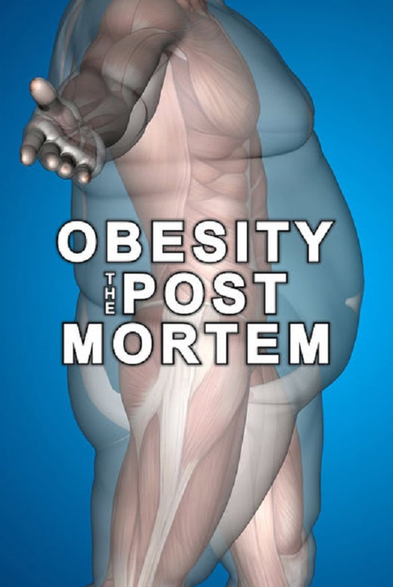 Obesity: The Post Mortem preview 2