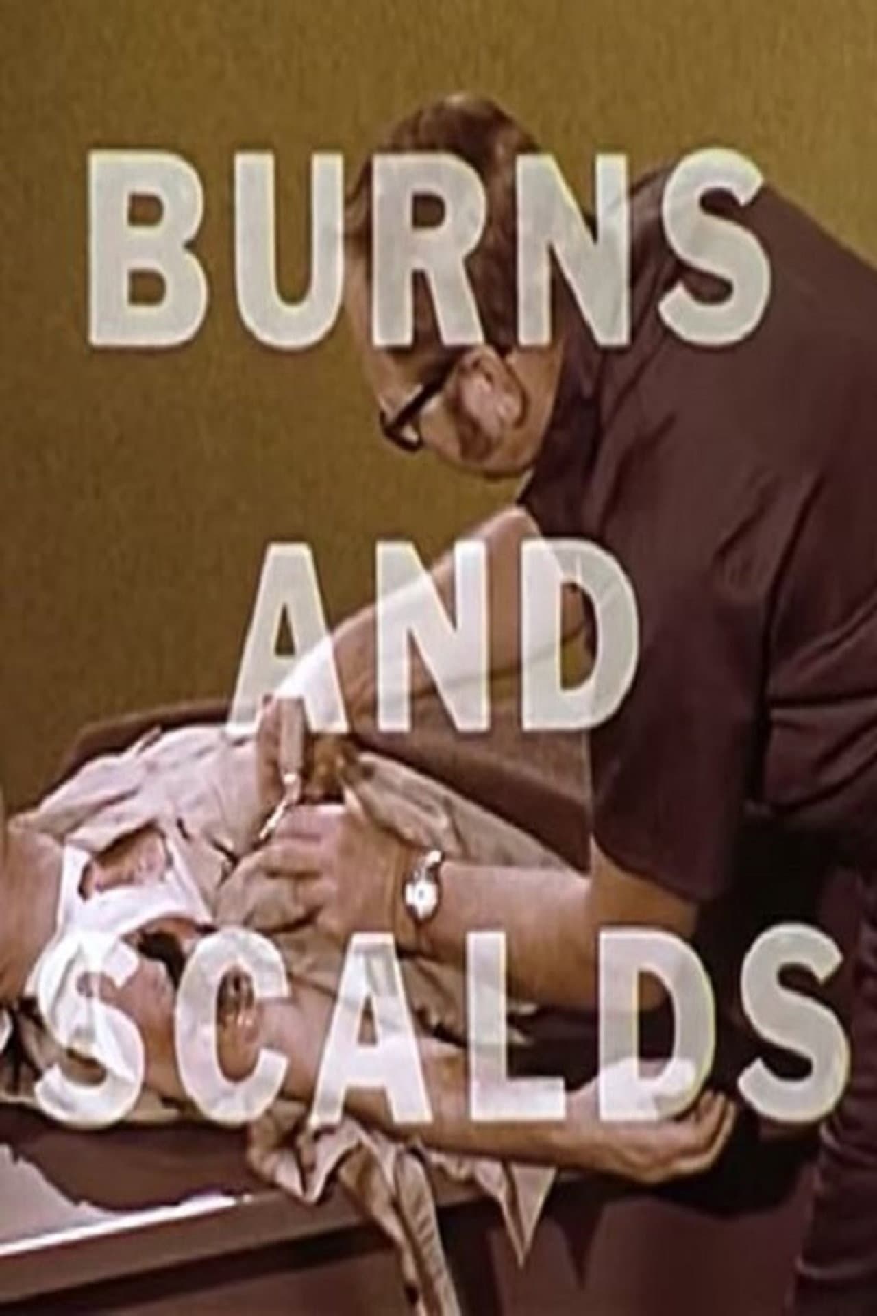 Burns And Scalds preview 1
