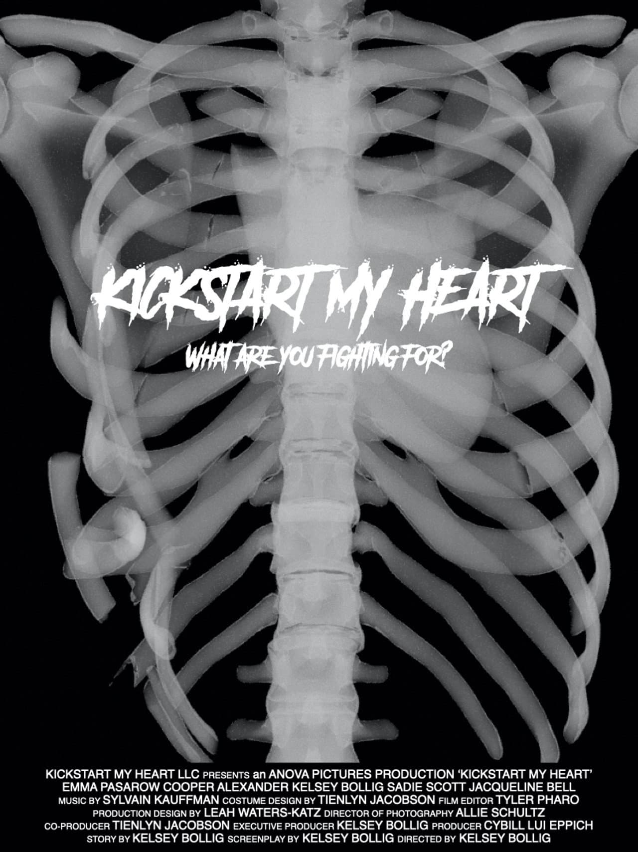 Kickstart My Heart preview 2
