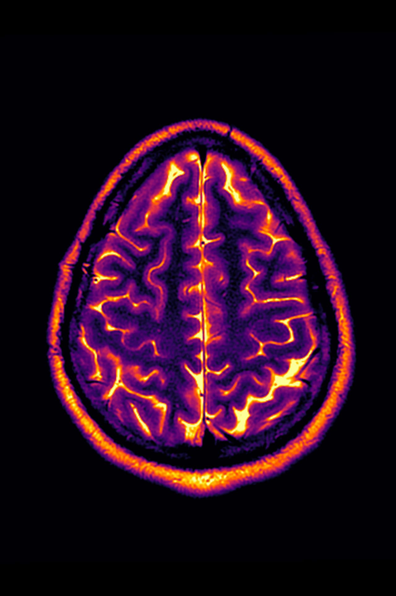 Conclusion: Stable Disease preview 1