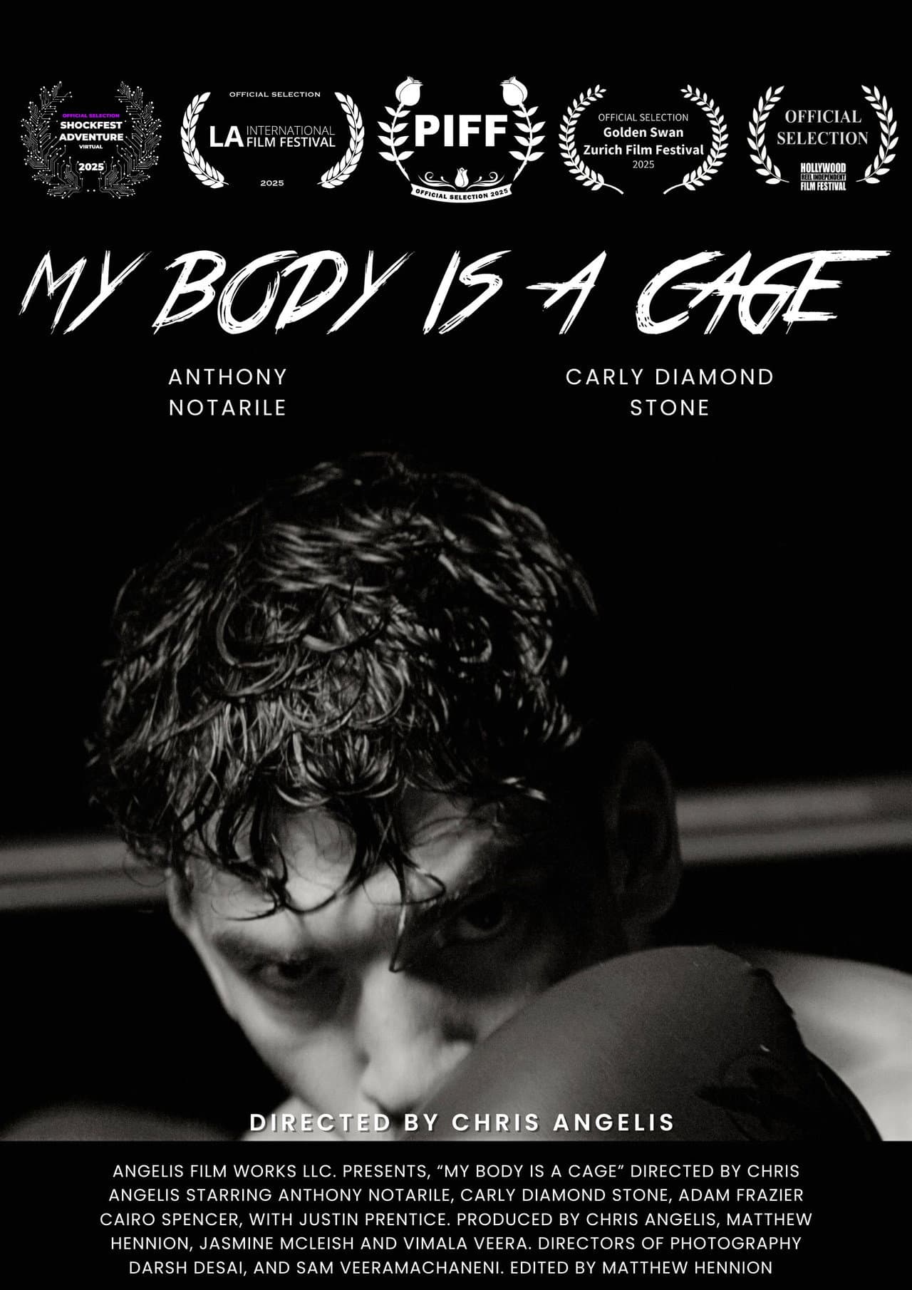 My Body Is A Cage preview 1